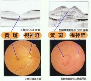 黄斑と視神経