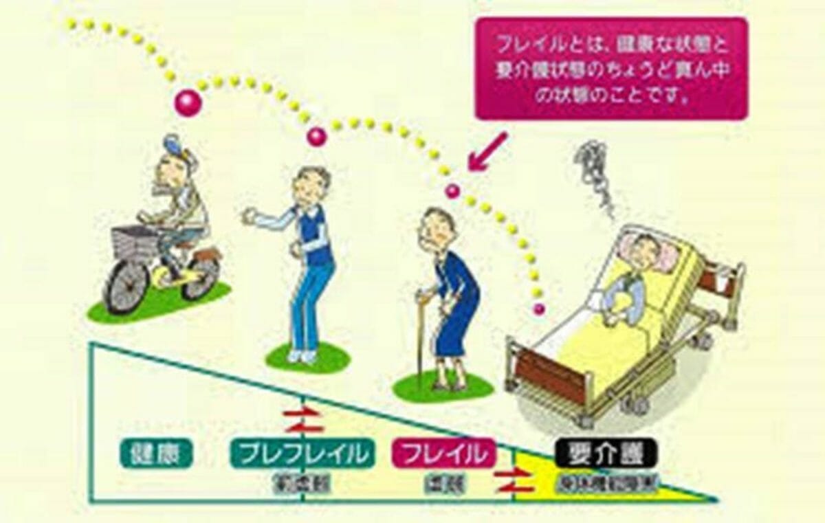 フレイル 健康な状態と要介護の中間 予防のすすめ Npo法人 黄斑変性友の会 フレイル 健康な状態と要介護の中間 予防のすすめ Npo法人 黄斑変性友の会