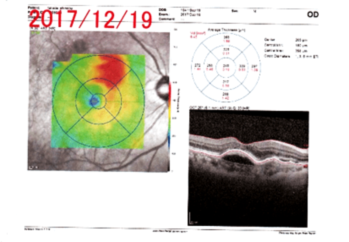 ad87bd75b74a9309f22df09cc65052