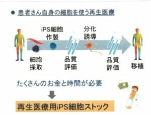 iPS細胞ストック