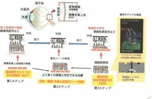 網膜の構造２